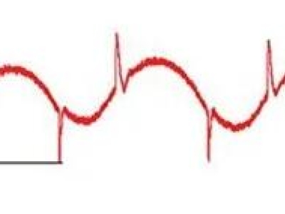 d2affe37ad7014b442e796de2f14a6a4